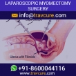 Low Cost Laparoscopic Myomectomy Surgery India - Travcure